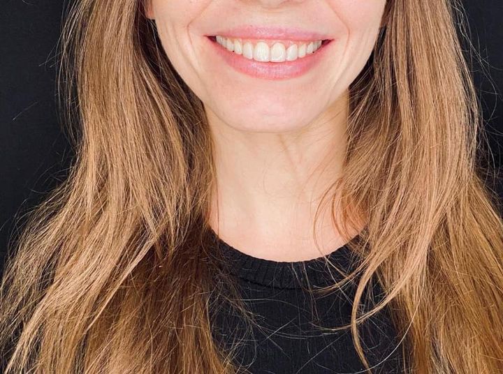 Invisalign - niewidzialna ortodoncja
