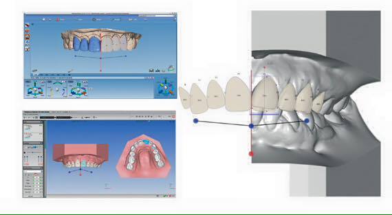 Smile Design - zobacz twój nowy, piękny uśmiech